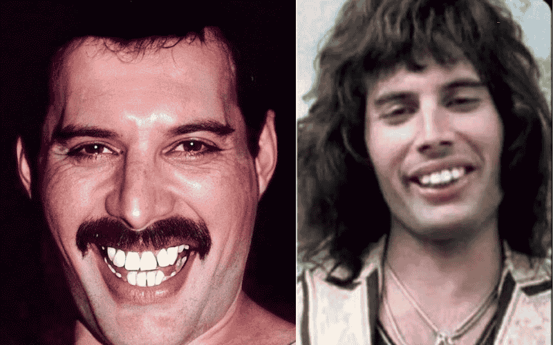 Freddie Mercury Teeth