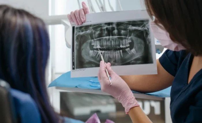 How-Do-I-Know-If-My-Wisdom-Teeth-Are-Coming-In-Correctly