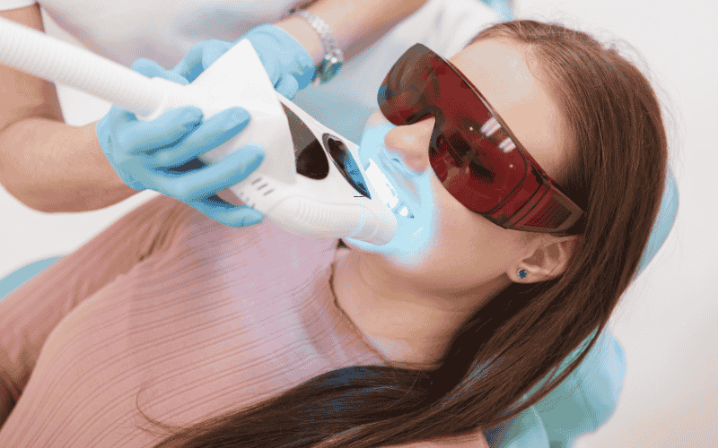 Teeth Whitening