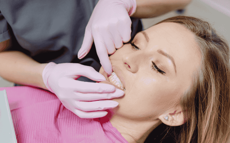 Why Experts Now Say Not to Remove Your Wisdom Teeth