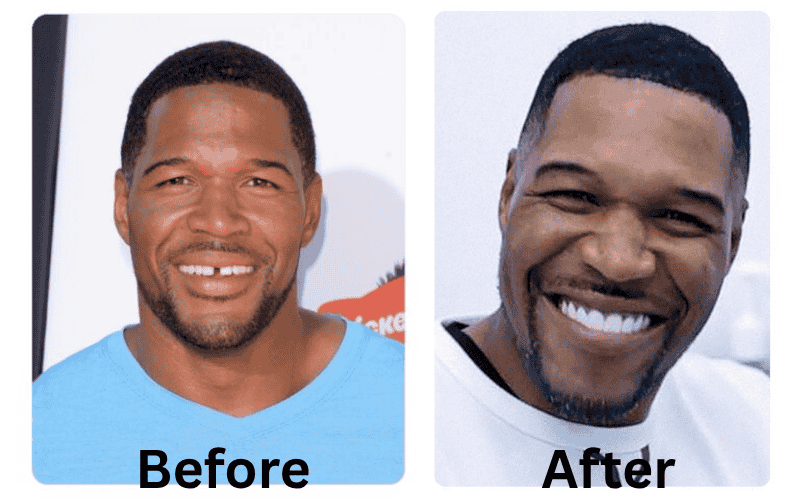 Michael Strahan Teeth