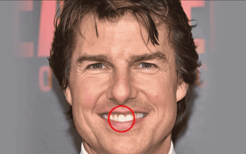 Tom Cruise’s Midline Shift Explained