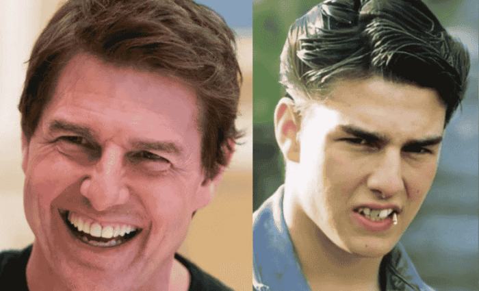 Tom Cruise Teeth