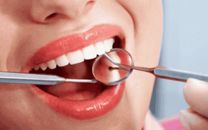 What Is a Dental Operculum?