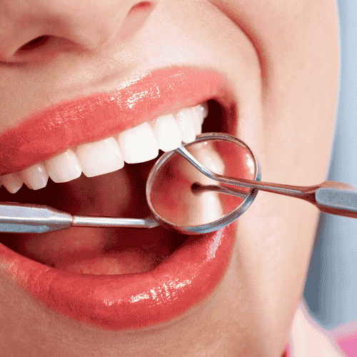 What Is a Dental Operculum? What Is a Dental Operculum?