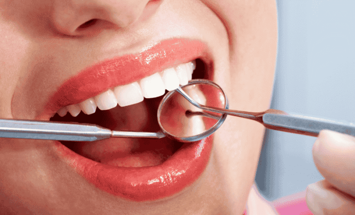What Is a Dental Operculum?