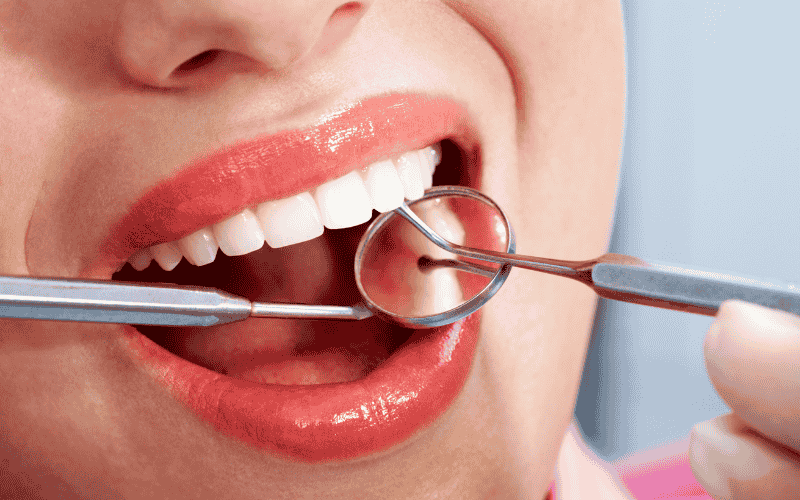 What Is a Dental Operculum?