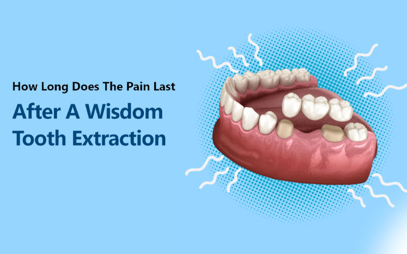 How Long Does Wisdom Tooth Pain Usually Last?