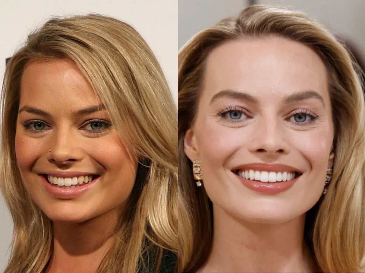 margot-robbie-teeth-before-after